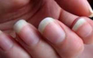 Почему загибаются ногти на руках