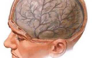 Арахноидит головного мозга